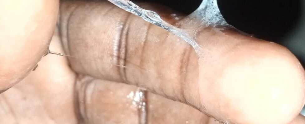 VAGINAL DISCHARGE